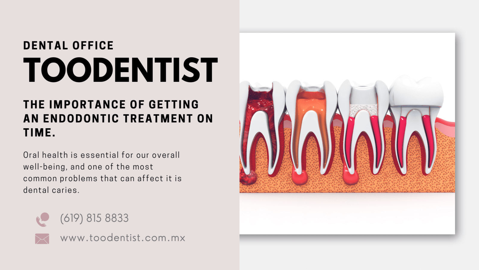 The importance of getting an endodontic on time.